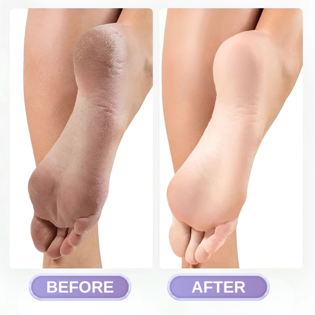 RadiantFeet™
