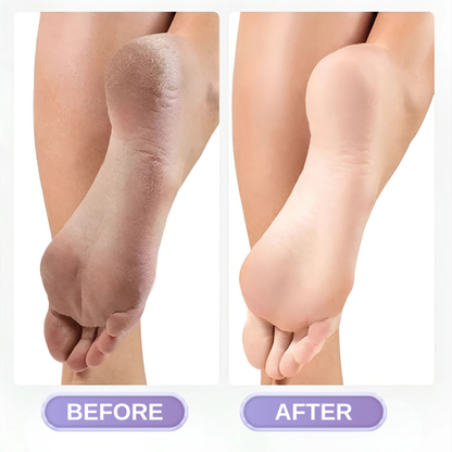 RadiantFeet™